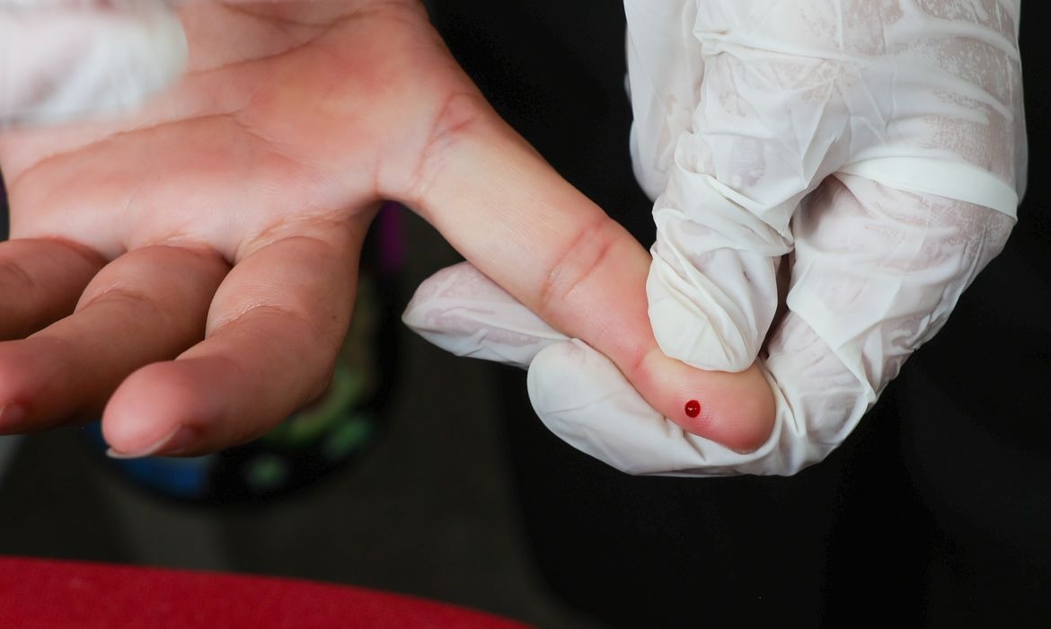 Brasil cumpre critérios para eliminar hepatite B