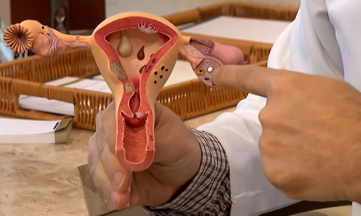 CNPq financia pesquisas sobre endometriose com foco no SUS